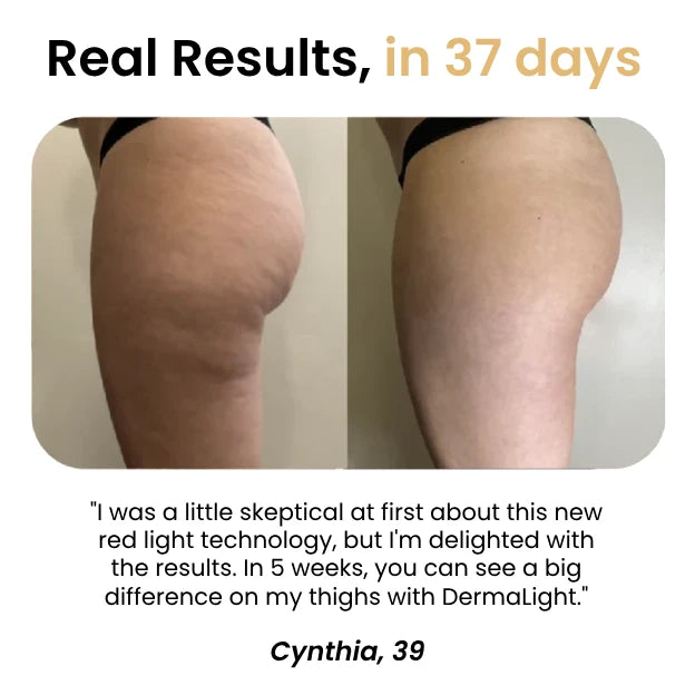 DermaLight™ Thigh Band