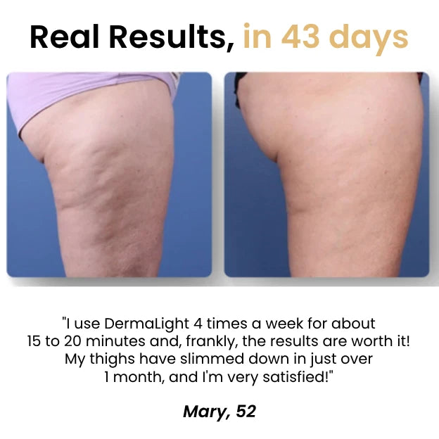 DermaLight™ Thigh Band