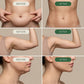 Lymora Lymphatic Drainage